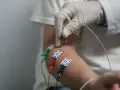 Badanie EMG: Co to jest? Przebieg, przygotowanie i czy boli?