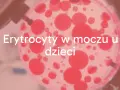 Badanie moczu: ogólne czy posiew? Zrozum różnice i diagnozę
