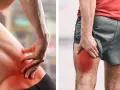 Douleur intense à la hanche et à la cuisse, signe de sciatique. Découvrez comment guerir une sciatique avec des exercices et des soins adaptés.
