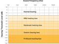 Graphique montrant les niveaux de perte auditive en fonction de la fréquence et du bruit decibel. De "normal hearing" à "profound hearing loss".