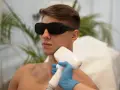 Mężczyzna w okularach ochronnych przechodzi zabieg depilacji laserowej brody.