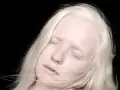 Delikatne, blade rysy twarzy i jasne włosy podkreślają niezwykłe oczy albinosa.