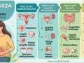 Ilustracja przedstawia przyczyny bólu brzucha i nietypowych krwawień u kobiet, od ginekologicznych po pokarmowe i inne.