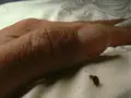 Una pequeña chinche se arrastra cerca de un dedo humano. Es una imagen inquietante que muestra el momento en que salen las chinches.