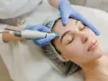 Aesthetician performs a facial treatment, likely part of the microdermabrasion healing process, on a woman's forehead.