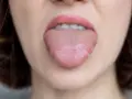 Spuchnięty język, lekko zaczerwieniony, wystaje z ust z różowymi wargami.