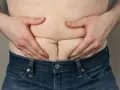 Mężczyzna ściska brzuch, uwidaczniając fałdy skóry i tkankę tłuszczową, co może sugerować cellulit u mężczyzn.
