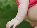 Różowe kropki na rączce dziecka mogą być jednym z objawów odry.