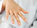 Una mano con algunas manchas, incluyendo un lunar visible en el dorso.