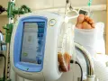 V.A.C.® Therapy Gerät mit gefülltem Behälter und einem Fuß im Verband. Die vac pumpe unterstützt die Wundheilung.