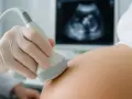 Ręka w rękawiczce medycznej wykonuje usg prenatalne. Na ekranie widoczny obraz płodu.