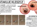 Kleszcz pod skórą to mit! Jak rozpoznać i bezpiecznie usunąć?