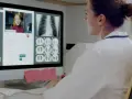 Ärztin analysiert Lungenaufnahmen am Bildschirm, während sie über den Frontallappen des Gehirns nachdenkt.