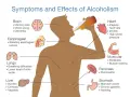 Ilustracja pokazuje skutki picia alkoholu: problemy z mózgiem, sercem, płucami, wątrobą, żołądkiem i mięśniami.