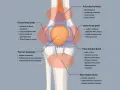 Diagram showing knee pain locations and causes. Excessive spinning can be bad for your knees, leading to issues like IT band syndrome or meniscus tears.