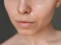 Nahaufnahme eines Gesichts, das zeigt, wie man fettige Haut pflegt. Die Haut glänzt leicht, was auf Feuchtigkeit hinweist.