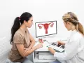 Lekarka wyjaśnia pacjentce, co to jest endometrium, pokazując schemat narządów rodnych na monitorze.