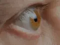 Occhio con iride ambrata e pupilla nera. La cornea deformata riflette la luce, creando un effetto visivo particolare.