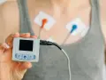 Holter co to? Urządzenie do monitorowania pracy serca z elektrodami na klatce piersiowej i małym rejestratorem w dłoni.