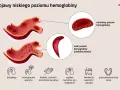 Ilustracja pokazuje objawy niskiego poziomu hemoglobiny, takie jak ból głowy, bladość i szybkie męczenie się. Dowiedz się, jak podnieść hemoglobinę.
