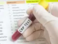 Ręka w rękawiczce trzyma probówkę z krwią do badania CRP. Wyniki wskazują na podwyższone CRP, co może świadczyć o stanie zapalnym.