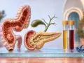 Anatomia układu pokarmowego: jelito grube, trzustka, pęcherzyk żółciowy, próbówki z płynami. Ca 19-9 to marker nowotworowy.