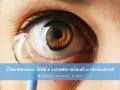 Occhio con cheratocono e lente a contatto applicata. Soluzioni per la visione con cheratocono.