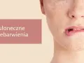 Jak poprawić koloryt cery? Widok zbliżenia na twarz z widocznymi przebarwieniami i piegami.