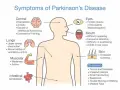 Objawy psychiczne w Parkinsonie: Jak je rozpoznać i leczyć?