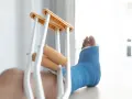Noga w niebieskim gipsie, z kulami obok, sugeruje złamanie podudzia łącznie ze stawem skokowym.