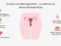 Grafik zeigt, wie man die Scheidenflora stärkt: Milchsäurebakterien, zuckerarme Ernährung, Baumwollunterwäsche, parfümfreie Intimpflege, Stressabbau. Dies hilft, eine Ursache für Scheidenpilz zu vermeiden.