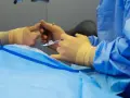 Mani guantate eseguono un intervento chirurgico oculare, forse un piombaggio retina, con precisione.