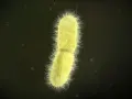 Żółta bakteria z licznymi rzęskami, przypominająca kształtem pałeczkę, to Klebsiella pneumoniae.