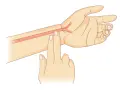 Zwei Finger auf dem Handgelenk, um den Puls zu messen. Eine Arterie ist sichtbar.