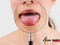 Powiększony pypeć na języku pod lupą.