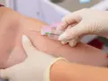 Pobieranie krwi do badań. Wyniki mogą wykazać, że limfocyty wysokie, co wymaga dalszej diagnostyki.