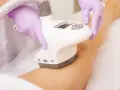Velashape czy endermologia – która metoda naprawdę działa lepiej?