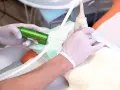 Arzt führt eine Brust-Biopsie mit einem speziellen Gerät durch. Hände in Handschuhen halten die Nadel und den Ultraschallkopf.