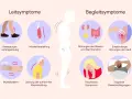 Die Grafik zeigt Leitsymptome wie verlangsamte Bewegung, Muskelsteifheit und Zittern, die auf eine Parkinson-Definition hinweisen. Begleitsymptome umfassen Blasen-/Darmstörungen, Hautempfindungsstörungen, psychische und kognitive Probleme.