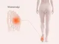 Illustration av en fot med markerad smärta i framfoten, som visar metatarsalgi. En figur visar smärtan i foten.