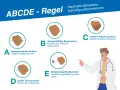 ABCDE-Regel: Asymmetrie, Begrenzung, Color, Durchmesser, Entwicklung. So können Sie Hautkrebs-Symptome frühzeitig erkennen.