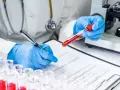 Ręce w niebieskich rękawiczkach trzymają probówkę z krwią i długopis nad dokumentem.