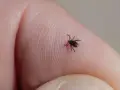 Kleszcz nie wchodzi pod skórę! Jak usunąć i co obserwować?