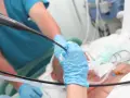 Lekarz w niebieskich rękawiczkach wykonuje bronchoskopię, wprowadzając endoskop do dróg oddechowych pacjenta podłączonego do aparatury medycznej.