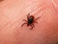 Una garrapata pequeña, con ocho patas, se arrastra sobre la piel humana.