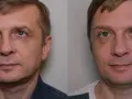 Laser frakcyjny nieablacyjny: Czy warto? Efekty, cena, opinie