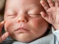 Jak wygląda skaza białkowa u niemowlaka? Przewodnik dla rodziców