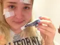 Jak stosować maść ichtiolową na pryszcze, aby uniknąć podrażnień
