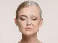 Gesichtshälfte einer jungen Frau neben einer älteren Frau, die zeigt, was bedeutet anti aging.