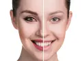 Risiken von permanentem Make-up Lidstrich: Was Sie wissen sollten